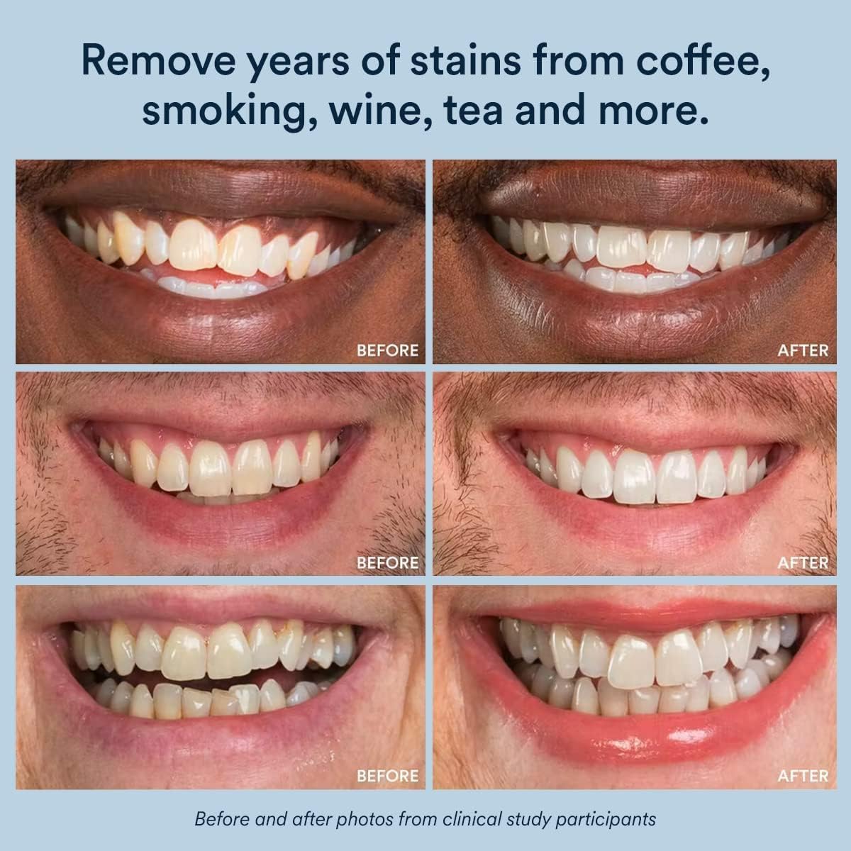 Hydrogen Peroxide Extra Strength Teeth Whitening Pen