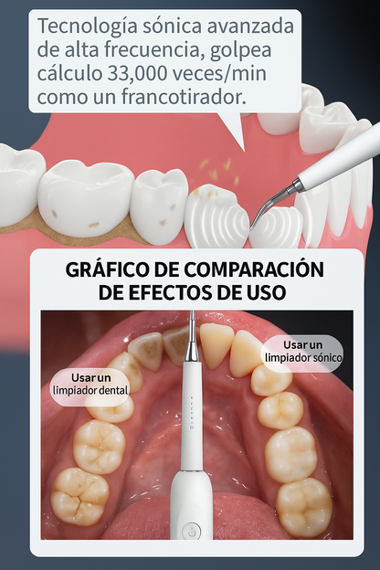 Electric Teeth Cleaner