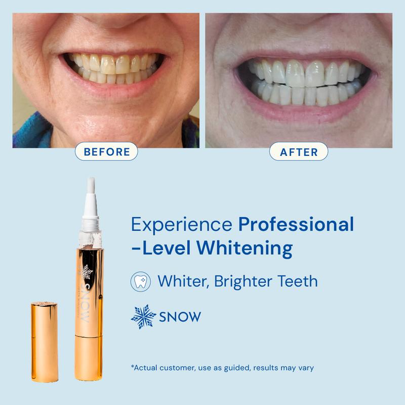 Extra-Strength Teeth Whitening Serum Pen