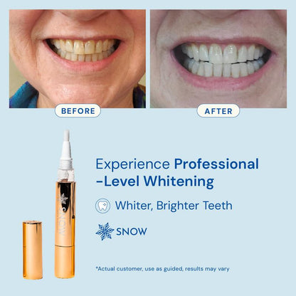 Extra-Strength Teeth Whitening Serum Pen